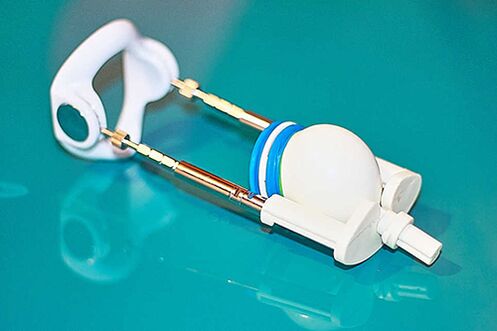 Paplašinātājs - ierīce efektīvai dalībnieka palielināšanai